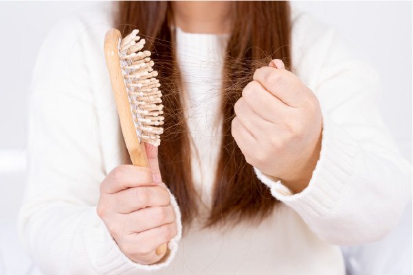 10 Reasons for Excessive Hair Loss