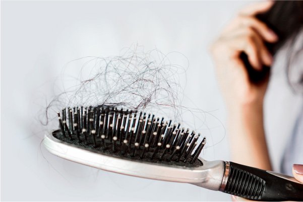 Conditions That Cause Hair Loss in Children  Hair Loss Center  Everyday  Health