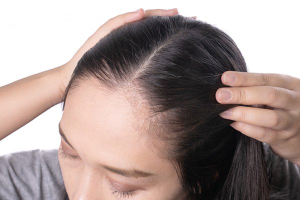 triphala hair care scalp